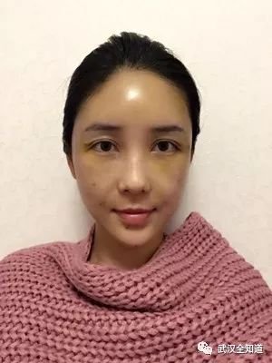 https://img.miyanlife.com/mnt/timg/171207/1203105H6-2.jpg