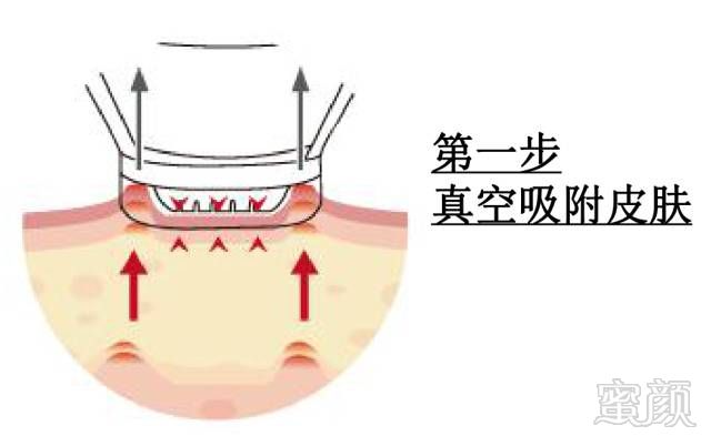 案例图片