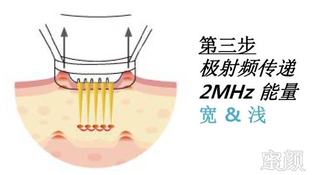 案例图片