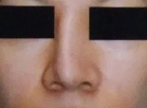 https://img.miyanlife.com/mnt/timg/171207/12420H354-1.jpg