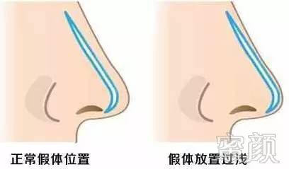 https://img.miyanlife.com/mnt/timg/171207/12420KL1-3.jpg