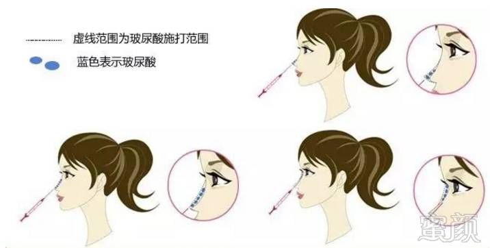 https://img.miyanlife.com/mnt/timg/171207/124233D16-10.jpg