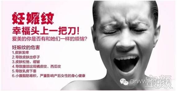 https://img.miyanlife.com/mnt/timg/171207/125Q132Y-1.jpg