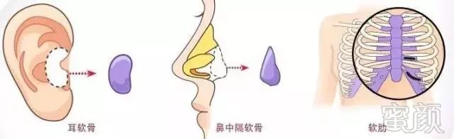 https://img.miyanlife.com/mnt/timg/171208/1535153C6-3.jpg