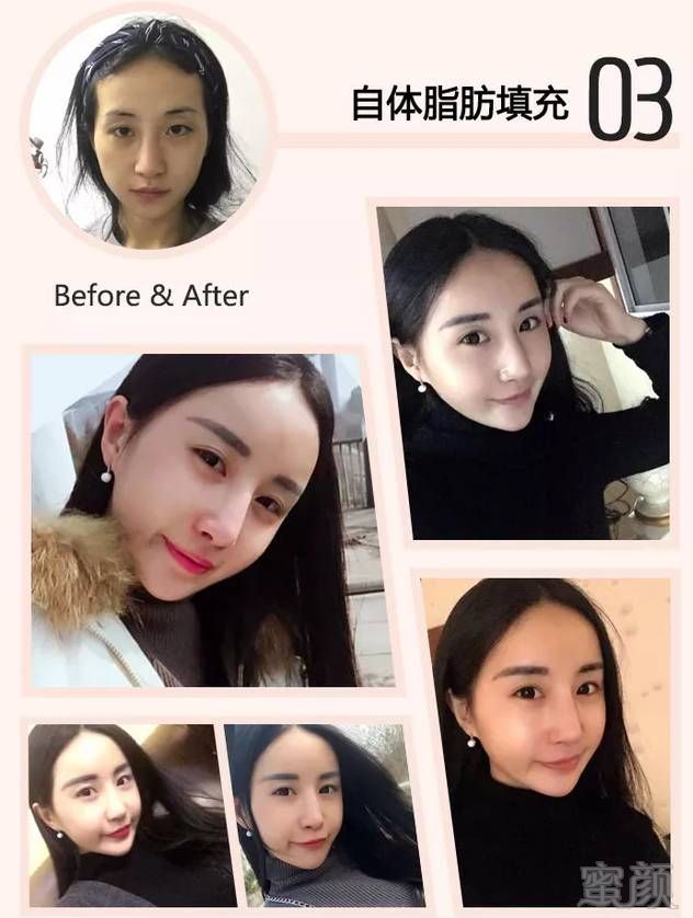 https://img.miyanlife.com/mnt/timg/171209/115K43505-4.jpg