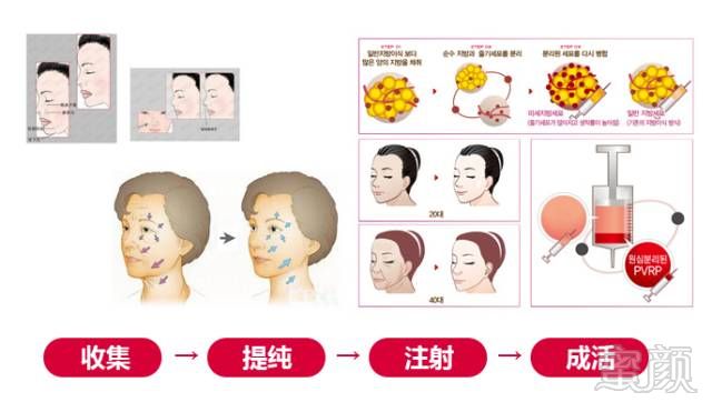 https://img.miyanlife.com/mnt/timg/171209/115K55c7-8.jpg