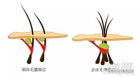 https://img.miyanlife.com/mnt/timg/171209/122Q12Q9-3.jpg