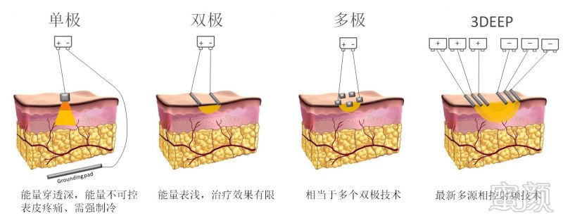 https://img.miyanlife.com/mnt/timg/171209/125621FU-1.jpg