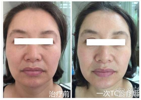 https://img.miyanlife.com/mnt/timg/171209/1256234J1-5.jpg