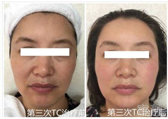 https://img.miyanlife.com/mnt/timg/171209/1256235247-6.jpg