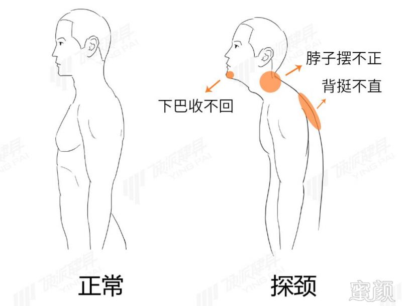 案例图片