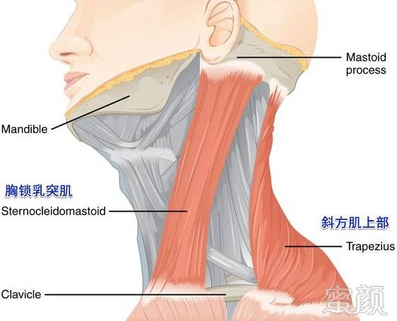 案例图片