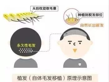 https://img.miyanlife.com/mnt/timg/171210/110I42404-2.jpg