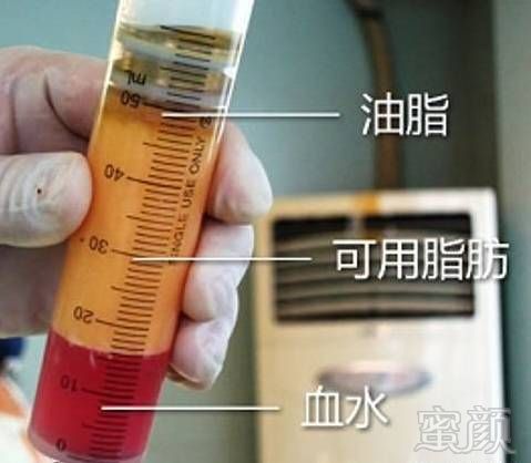 https://img.miyanlife.com/mnt/timg/171210/11324A258-5.jpg