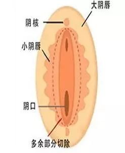 案例图片