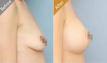 https://img.miyanlife.com/mnt/timg/171212/115220MU-18.jpg
