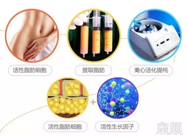 https://img.miyanlife.com/mnt/timg/171213/14132G010-1.jpg