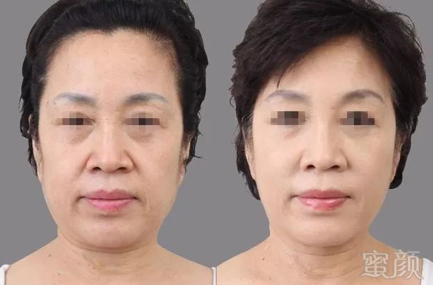 https://img.miyanlife.com/mnt/timg/171214/123141BB-1.jpg