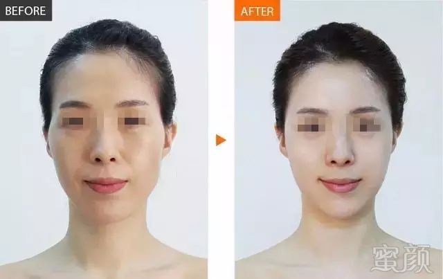 https://img.miyanlife.com/mnt/timg/171215/110P12G4-11.jpg