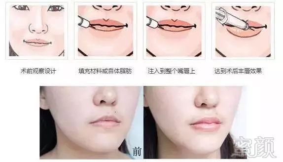 https://img.miyanlife.com/mnt/timg/171215/1134146440-6.jpg