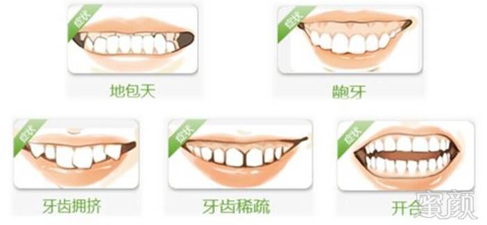 https://img.miyanlife.com/mnt/timg/171215/114A41N4-1.jpg