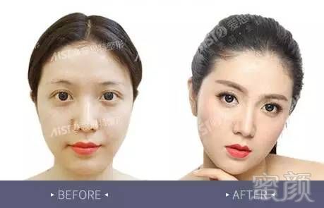 https://img.miyanlife.com/mnt/timg/171215/12303M364-4.jpg