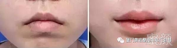 https://img.miyanlife.com/mnt/timg/171215/12333362G-6.jpg