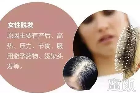 https://img.miyanlife.com/mnt/timg/171216/1054504250-3.jpg