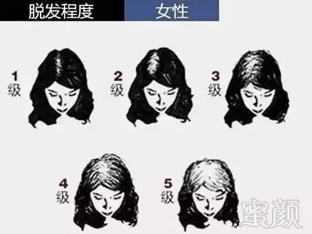 https://img.miyanlife.com/mnt/timg/171216/1054504450-5.jpg