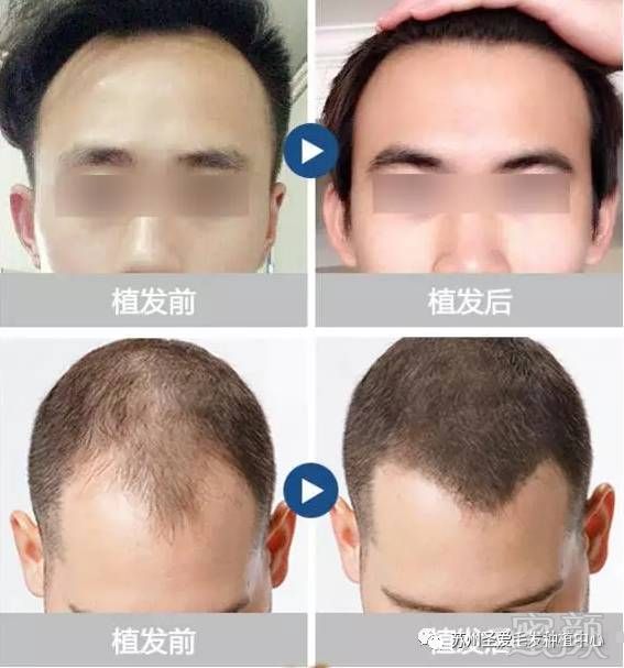 https://img.miyanlife.com/mnt/timg/171216/1054511330-8.jpg