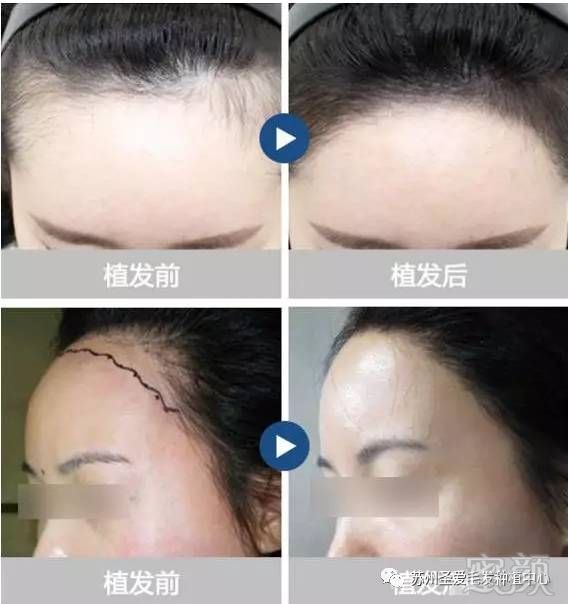 https://img.miyanlife.com/mnt/timg/171216/105452B91-9.jpg