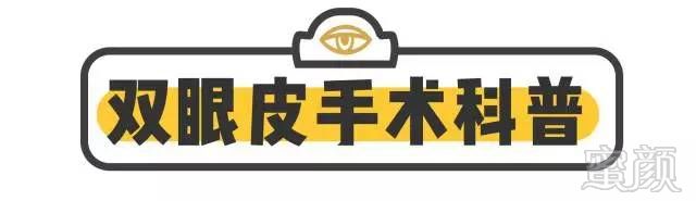 https://img.miyanlife.com/mnt/timg/171216/1150042Z7-1.jpg