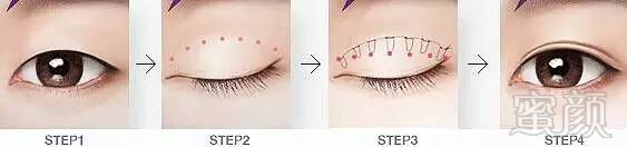https://img.miyanlife.com/mnt/timg/171216/1150055B6-3.jpg