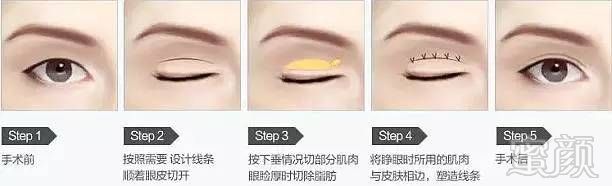https://img.miyanlife.com/mnt/timg/171216/1150063521-6.jpg