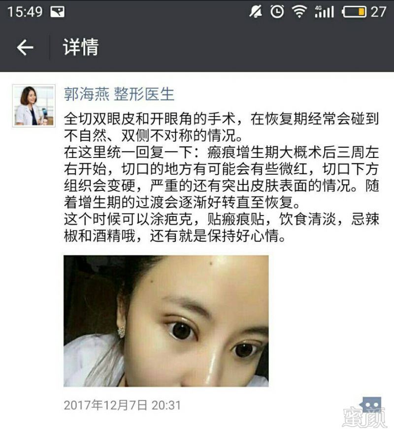 https://img.miyanlife.com/mnt/timg/171216/11500JE6-10.jpg