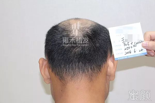 https://img.miyanlife.com/mnt/timg/171216/1159145056-2.jpg