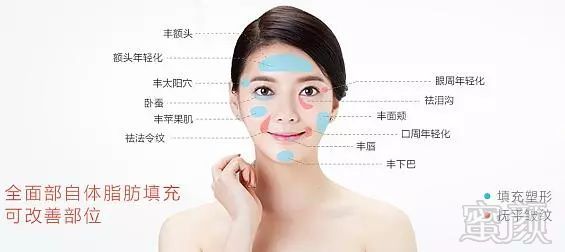 https://img.miyanlife.com/mnt/timg/171216/12002545C-2.jpg