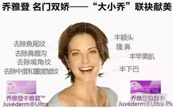 https://img.miyanlife.com/mnt/timg/171216/1223004924-0.jpg