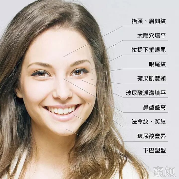 https://img.miyanlife.com/mnt/timg/171216/1223015255-7.jpg