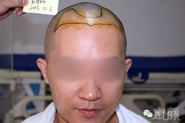 https://img.miyanlife.com/mnt/timg/171216/1449595241-2.jpg