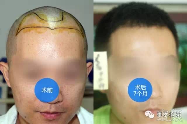 https://img.miyanlife.com/mnt/timg/171216/14495S560-0.jpg