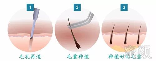 https://img.miyanlife.com/mnt/timg/171216/144FC546-6.jpg