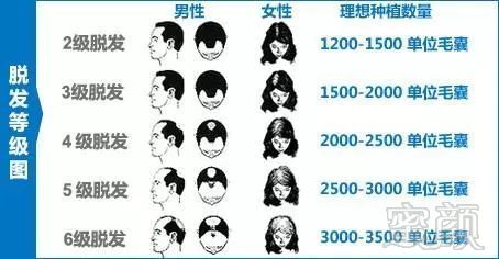 https://img.miyanlife.com/mnt/timg/171216/144FG931-9.jpg