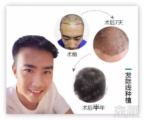 https://img.miyanlife.com/mnt/timg/171216/144FJC2-8.jpg