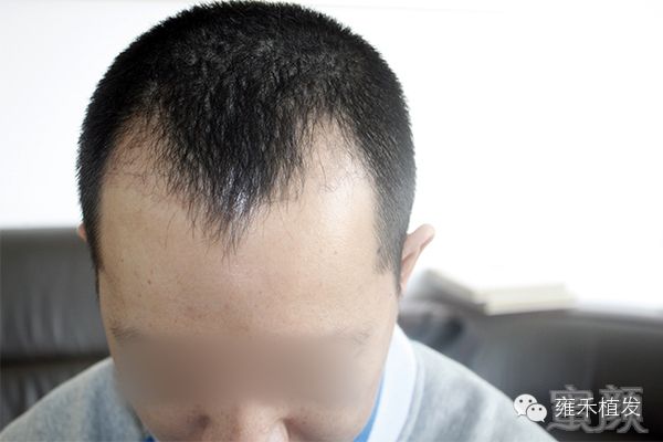 https://img.miyanlife.com/mnt/timg/171216/14500IQ3-12.jpg