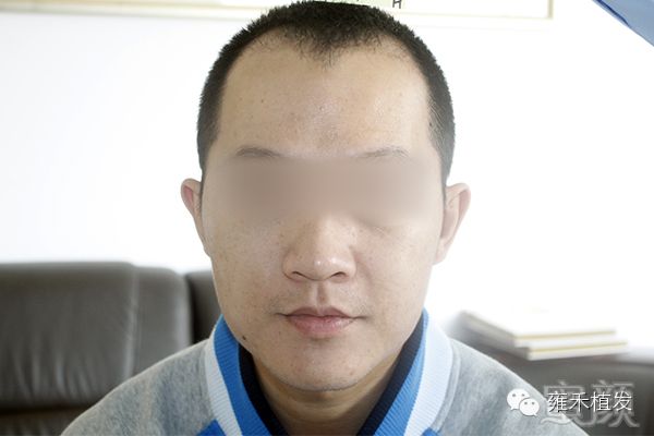 https://img.miyanlife.com/mnt/timg/171216/14500JM7-11.jpg