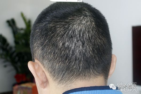 https://img.miyanlife.com/mnt/timg/171216/14500W2T-13.jpg