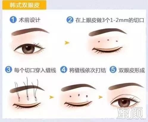 https://img.miyanlife.com/mnt/timg/171216/15101221R-2.jpg