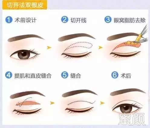 https://img.miyanlife.com/mnt/timg/171216/1510123A5-3.jpg