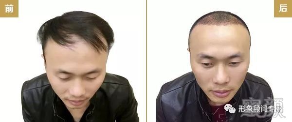 https://img.miyanlife.com/mnt/timg/171217/1230195302-2.jpg